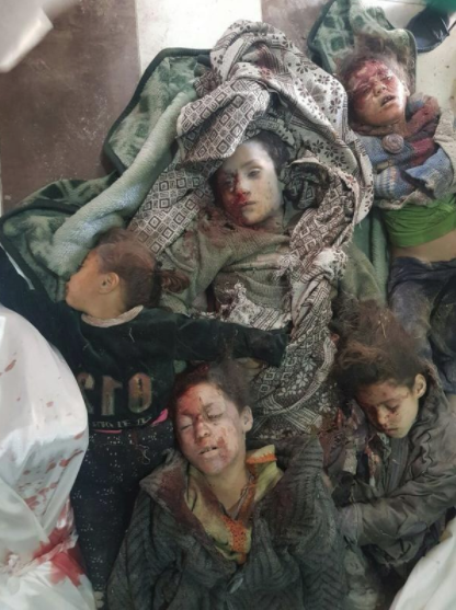 اطفال سوريين ضحايا القصف علي الغوطة  الشرقيه 