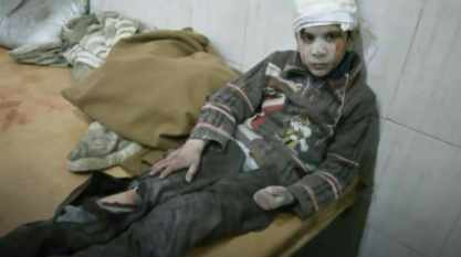  طفل سوري من ضحايا القصف علي الغوطة  الشرقيه 