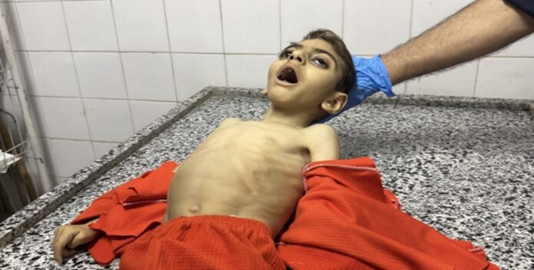 الأمم المتحدة تؤكد: غزة تواجه المجاعة رسمياً